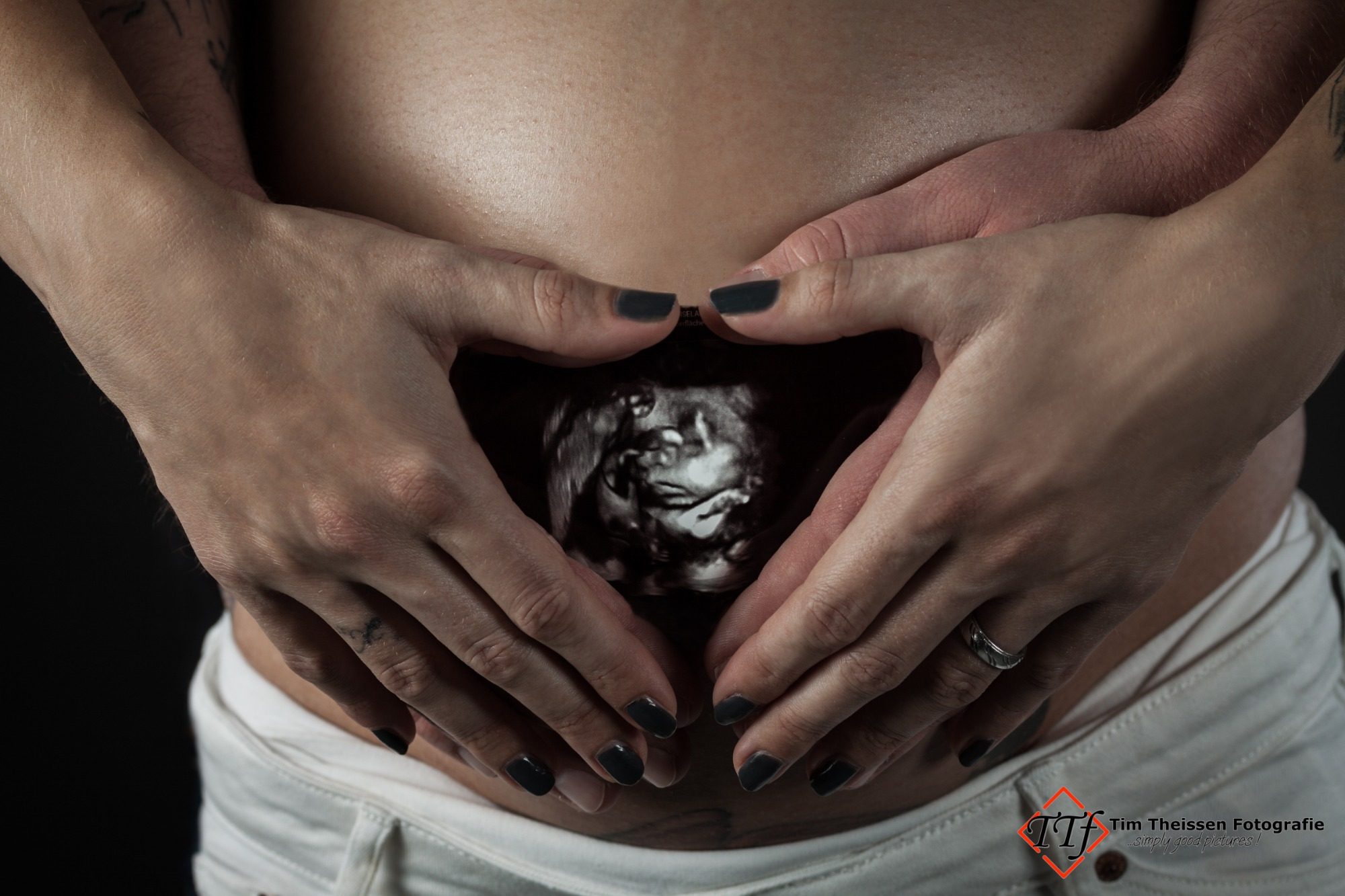 Babybauch Hände formen ein Herz über einem Babybauch mit Ultraschallbild im Zentrum.